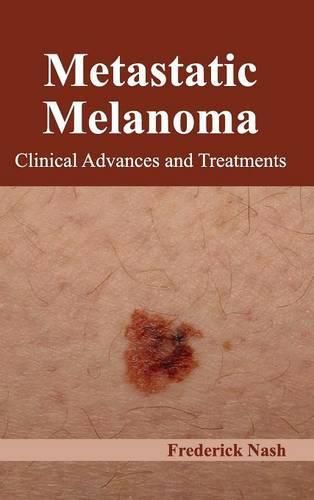 Cover image for Metastatic Melanoma: Clinical Advances and Treatments