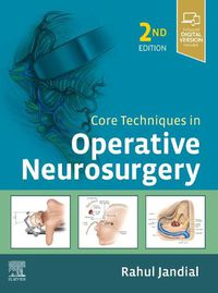 Cover image for Core Techniques in Operative Neurosurgery