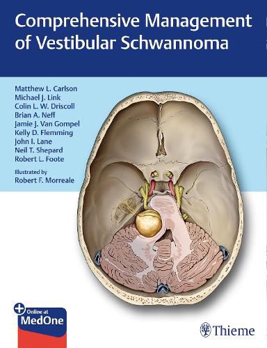 Cover image for Comprehensive Management of Vestibular Schwannoma