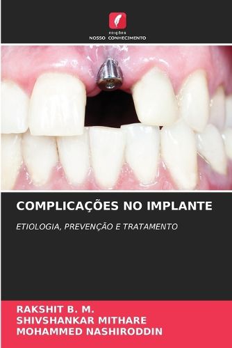 Cover image for Complicacoes No Implante