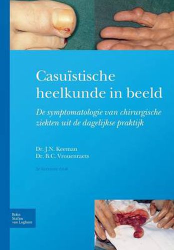 Cover image for Casuistische Heelkunde in Beeld: Symptomatologie Van Chirurgische Ziekten in de Dagelijkse Praktijk