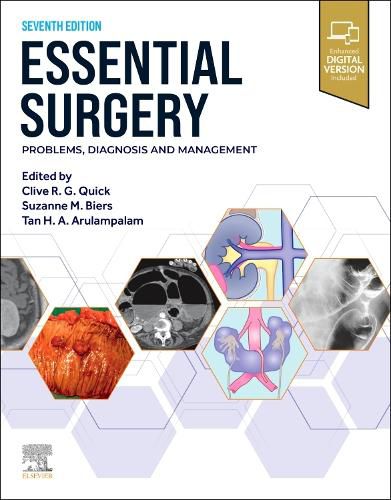 Cover image for Essential Surgery