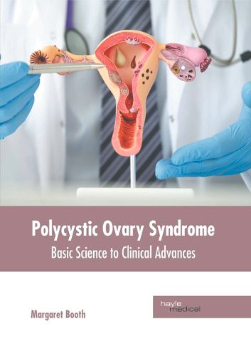 Cover image for Polycystic Ovary Syndrome: Basic Science to Clinical Advances