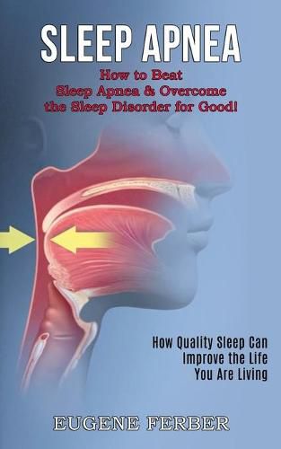 Cover image for Sleep Apnea: How Quality Sleep Can Improve the Life You Are Living (How to Beat Sleep Apnea & Overcome the Sleep Disorder for Good!)