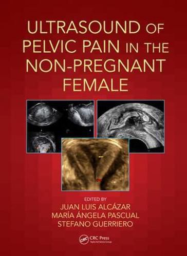 Cover image for Ultrasound of Pelvic Pain in the Non-Pregnant Female