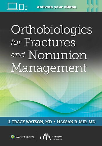 Cover image for Orthobiologics for Fractures and Nonunion Management