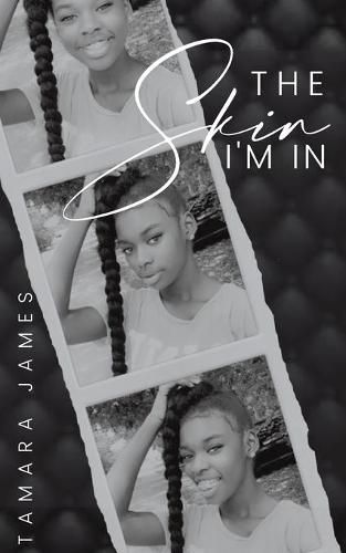 Cover image for The Skin I'm In