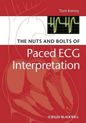 Cover image for The Nuts and Bolts of Paced ECG Interpretation