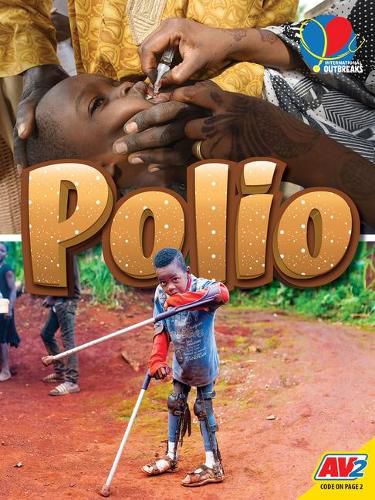 Polio