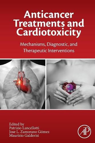 Cover image for Anticancer Treatments and Cardiotoxicity: Mechanisms, Diagnostic and Therapeutic Interventions