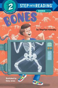 Cover image for Bones