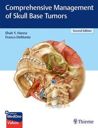 Cover image for Comprehensive Management of Skull Base Tumors