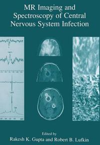 Cover image for MR Imaging and Spectroscopy of Central Nervous System Infection