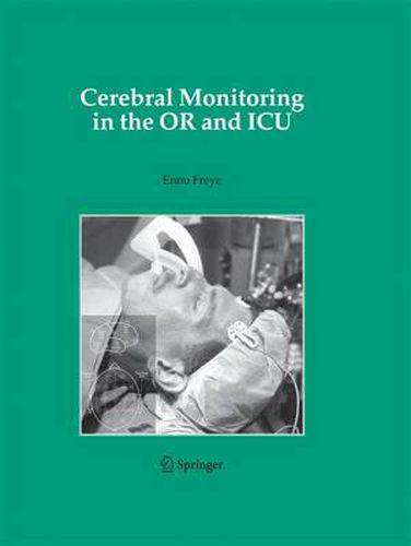 Cover image for Cerebral Monitoring in the OR and ICU