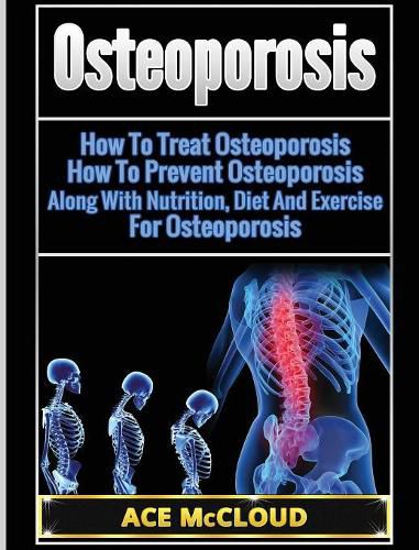 Cover image for Osteoporosis: How To Treat Osteoporosis: How To Prevent Osteoporosis: Along With Nutrition, Diet And Exercise For Osteoporosis