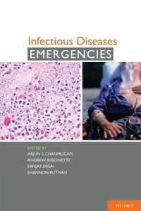 Cover image for Infectious Diseases Emergencies