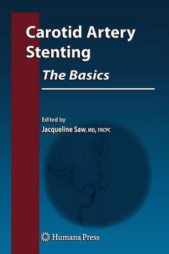 Cover image for Carotid Artery Stenting: The Basics