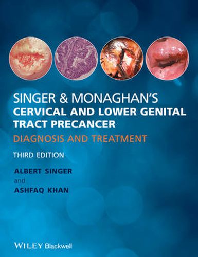 Cover image for Singer and Monaghan's Cervical and Lower Genital Tract Precancer: Diagnosis and Treatment