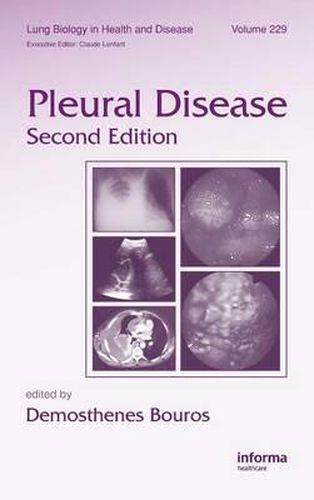 Cover image for Pleural Disease