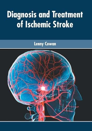 Cover image for Diagnosis and Treatment of Ischemic Stroke