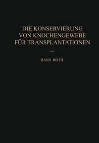 Cover image for Die Konservierung von Knochengewebe fur Transplantationen