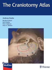 Cover image for The Craniotomy Atlas