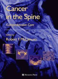 Cover image for Cancer in the Spine: Comprehensive Care