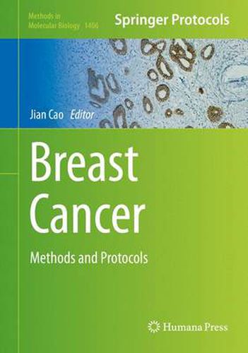 Cover image for Breast Cancer: Methods and Protocols