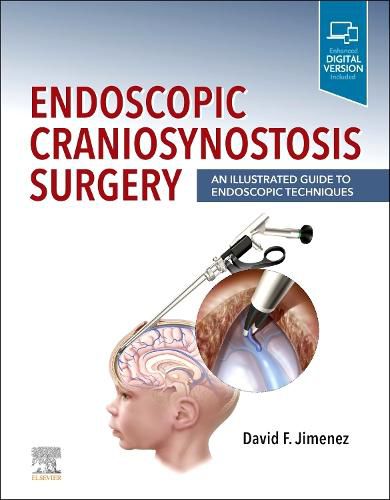 Cover image for Endoscopic Craniosynostosis Surgery: An Illustrated Guide to Endoscopic Techniques