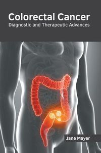 Cover image for Colorectal Cancer: Diagnostic and Therapeutic Advances