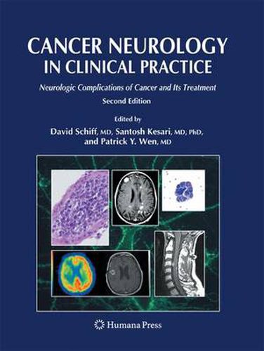 Cover image for Cancer Neurology in Clinical Practice: Neurologic Complications of Cancer and Its Treatment