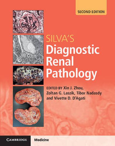 Cover image for Silva's Diagnostic Renal Pathology