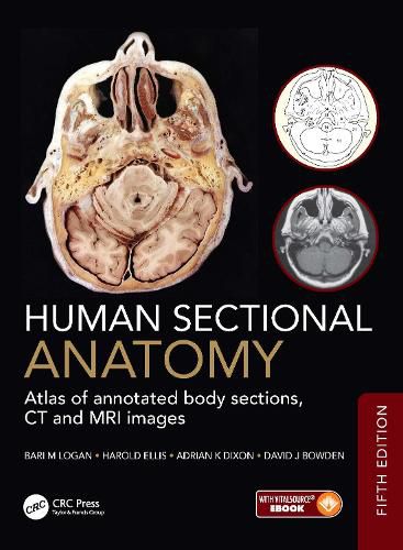 Cover image for Human Sectional Anatomy