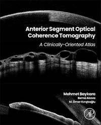 Cover image for Anterior Segment Optical Coherence Tomography