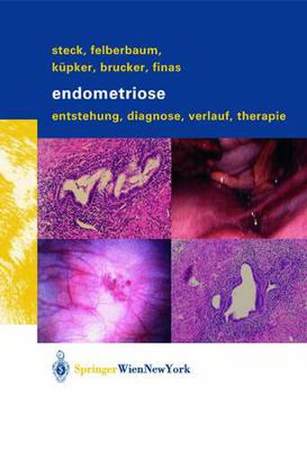 Cover image for Endometriose: Entstehung, Diagnose, Verlauf und Therapie