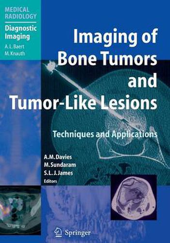 Imaging of Bone Tumors and Tumor-Like Lesions: Techniques and Applications