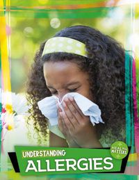 Cover image for Understanding Allergies