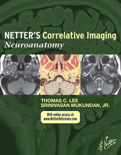 Cover image for Netter's Correlative Imaging: Neuroanatomy: with NetterReference.com Access