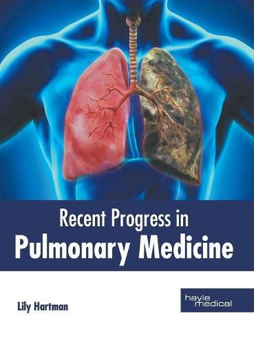 Cover image for Recent Progress in Pulmonary Medicine