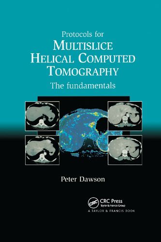 Protocols for Multislice Helical Computed Tomography: The Fundamentals