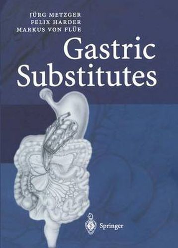 Cover image for Gastric Substitutes