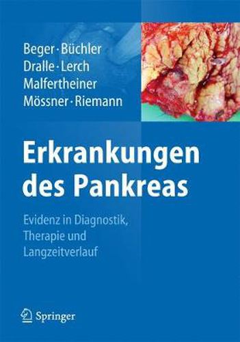 Cover image for Erkrankungen des Pankreas: Evidenz in Diagnostik, Therapie und Langzeitverlauf