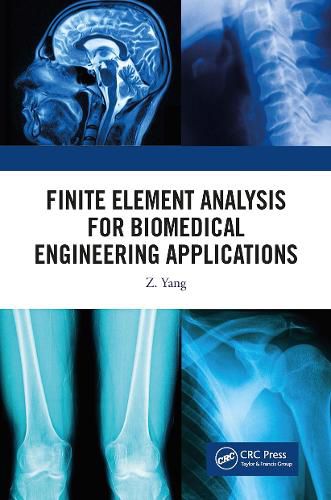 Cover image for Finite Element Analysis for Biomedical Engineering Applications