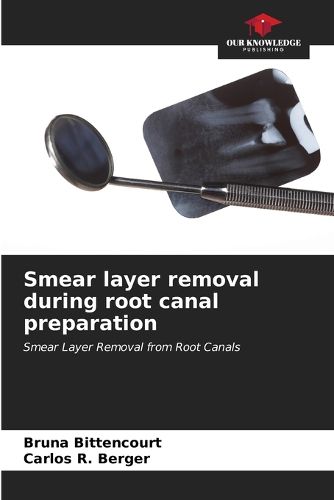 Smear layer removal during root canal preparation