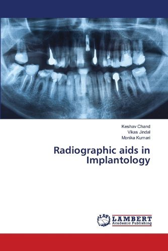 Cover image for Radiographic aids in Implantology