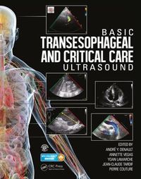 Cover image for Basic Transesophageal and Critical Care Ultrasound