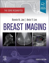 Cover image for Breast Imaging: The Core Requisites