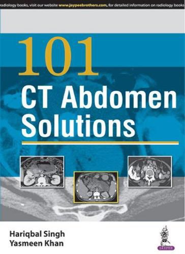 Cover image for 101 CT Abdomen Solutions