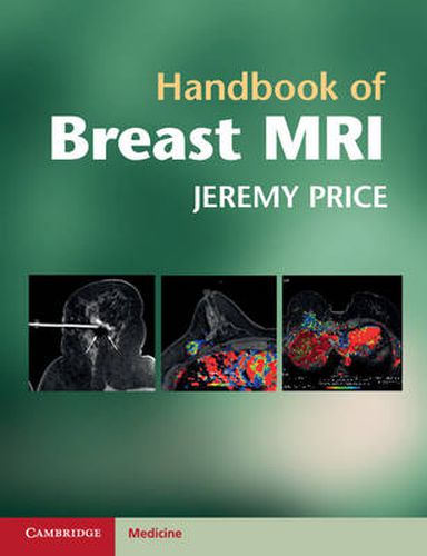 Cover image for Handbook of Breast MRI