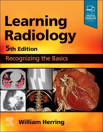 Cover image for Learning Radiology: Recognizing the Basics